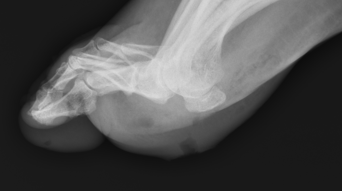 Figure 1; x ray
